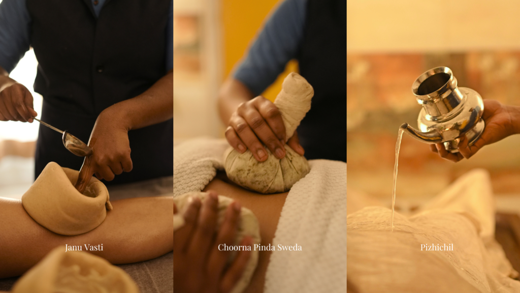 Classical Panchakarma treatments for Arthritis include Janu Vasti, Pizhichil, Choorna Pinda Sweda, etc 