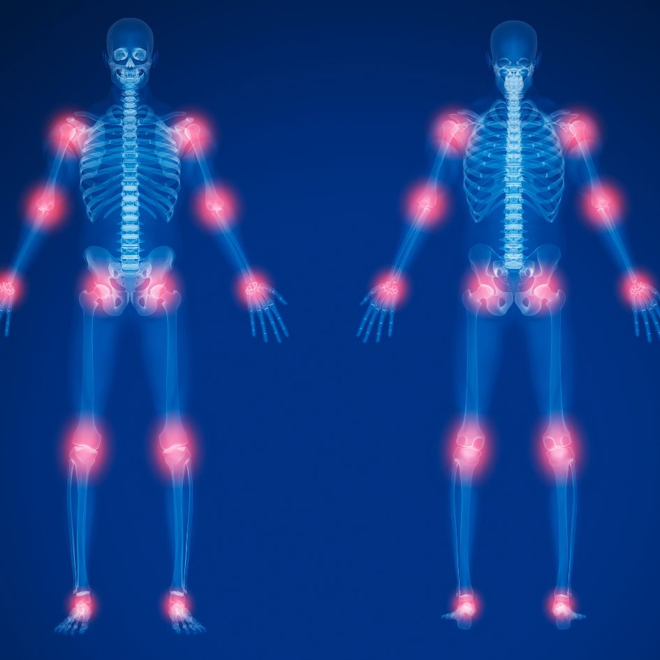 Best Ayurvedic Treatment for Arthritis